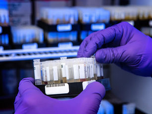 Covid-19: anticorpos podem durar até 12 meses após infecção