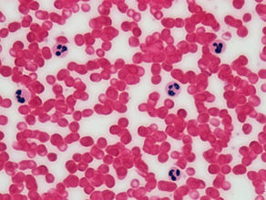 Understanding Blood Work: Why “Normal” Does Not Always Mean Optimal